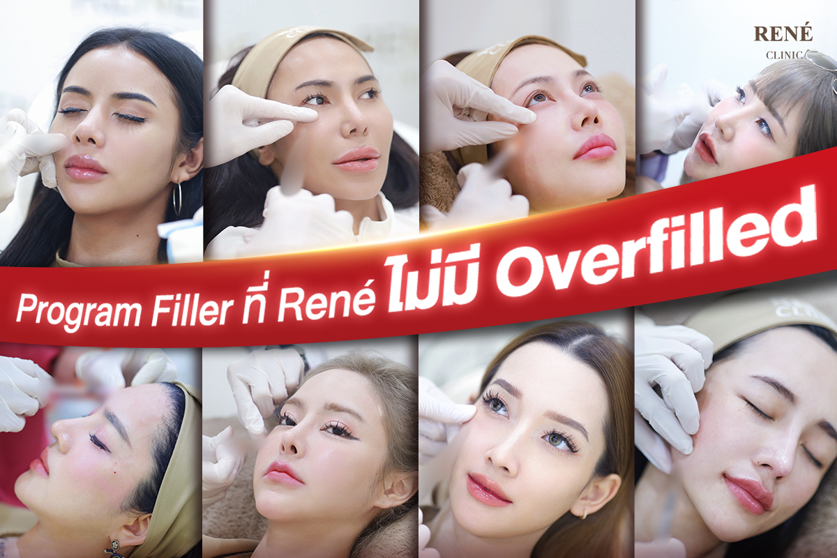 ปรับรูปหน้าไม่เสี่ยง Overfilled
