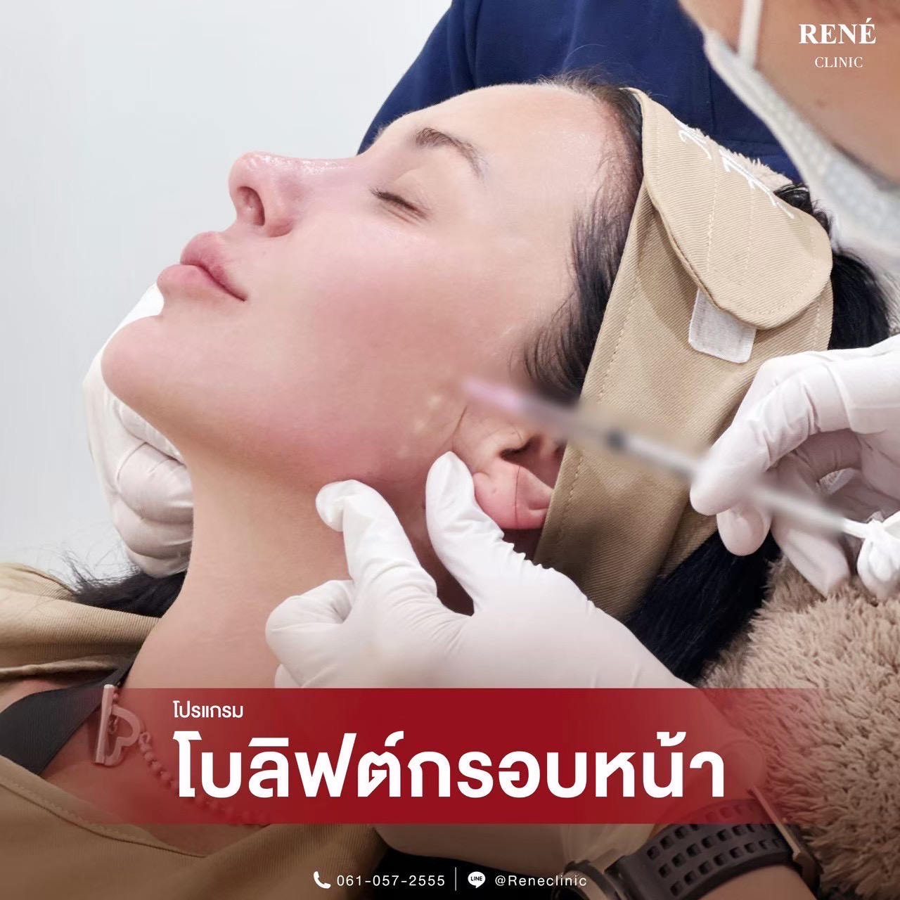 รีวิว Botox #16